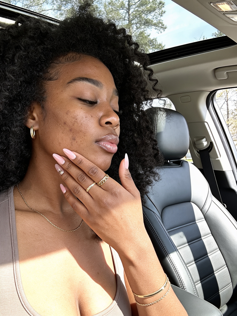 Before You Buy Another Product for Dark Spots, Read This First