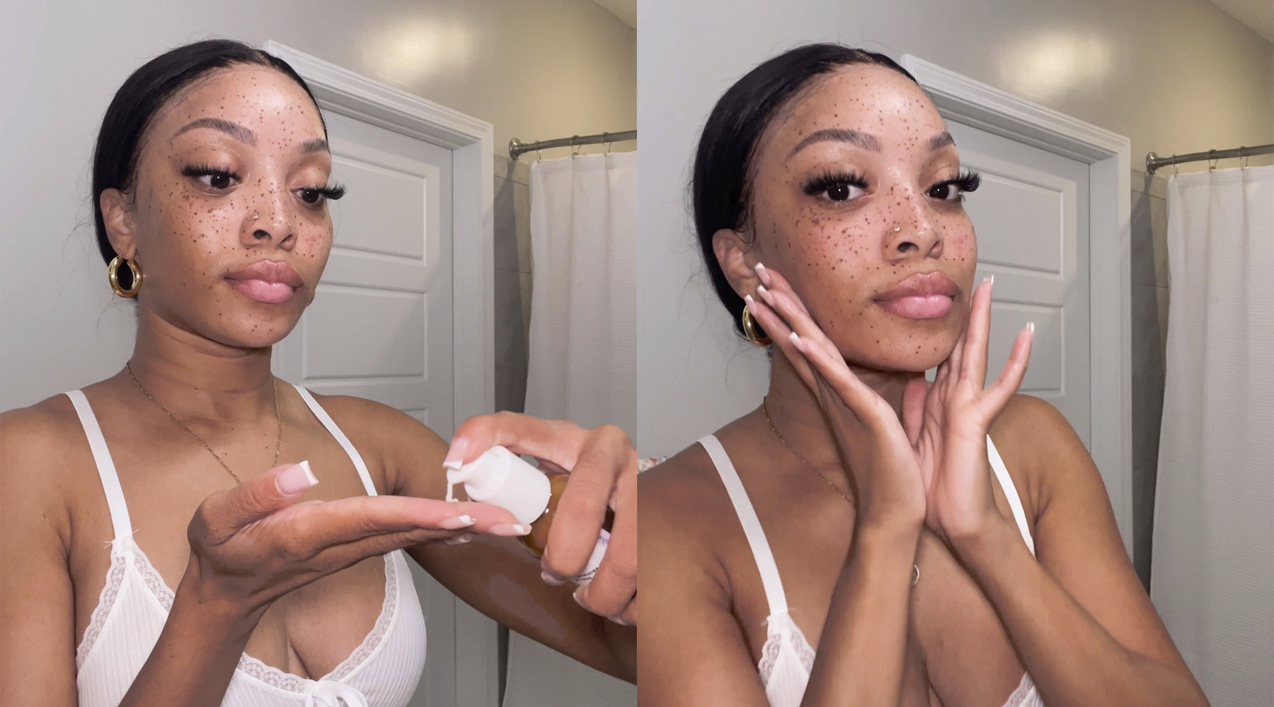 Why Vitamin C is the GOAT for Fading Dark Spots—No Bleaching Needed