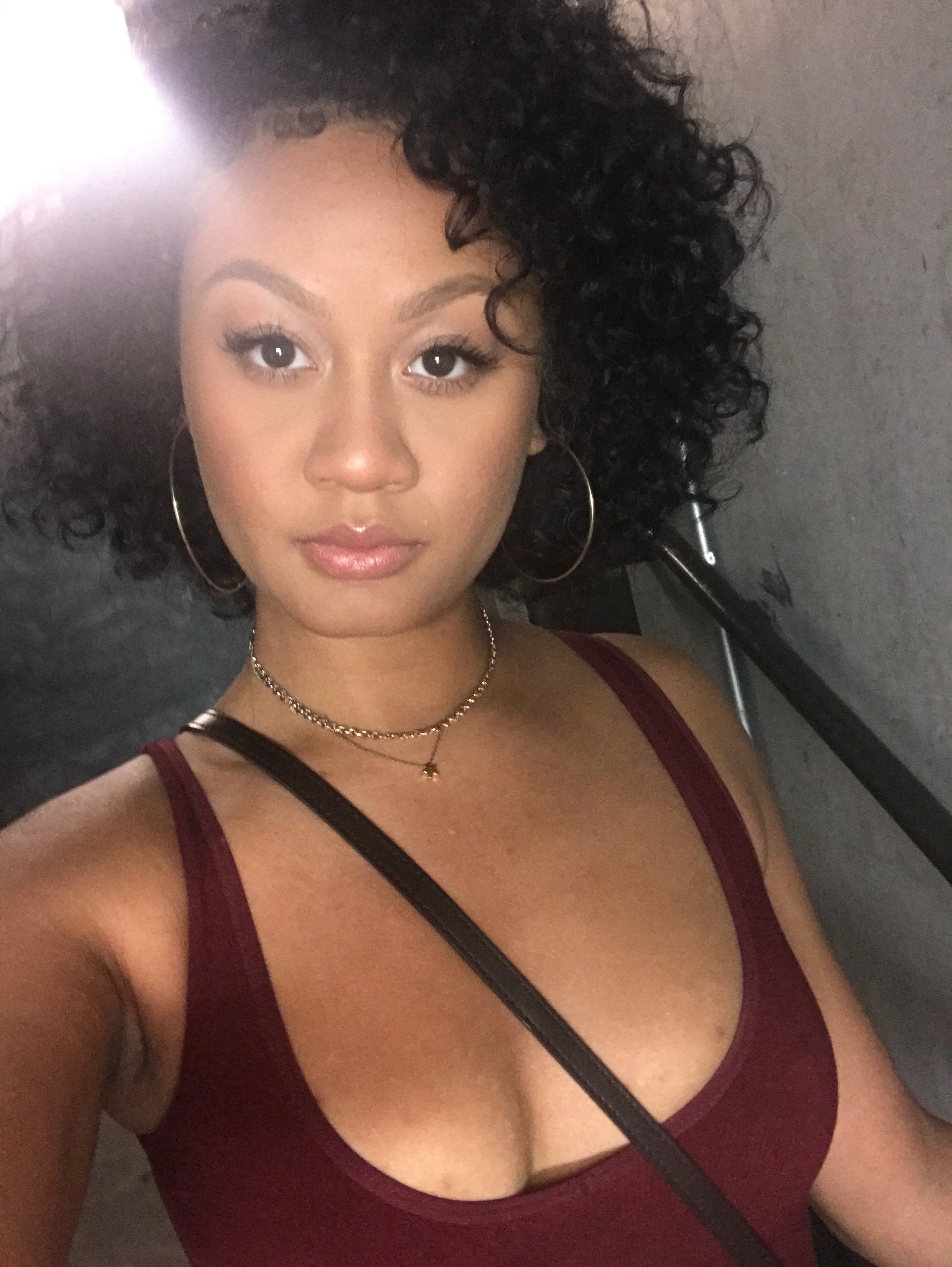 Alexys' Journey to Better Skin